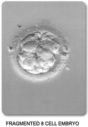 Fragmented 8-Cell Embryo