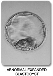 Abnormal Degenerating Blastocyst
