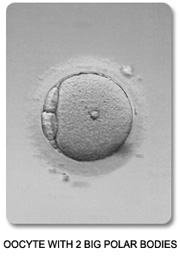 Abnormal Oocyte
