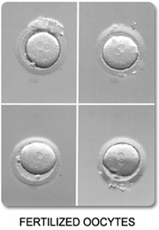 Multiple Fertilized Eggs