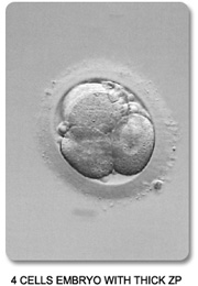 4-Cell with Thickened Zona